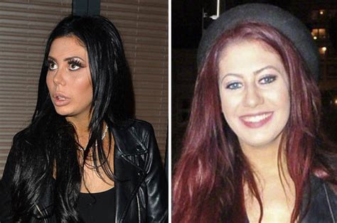 chloe before and after surgery|chloe ferry surgery before and after.